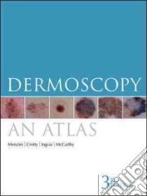 Dermoscopy libro in lingua di Menzies Scott W., Crotty Kerry A., Ingvar Christian, McCarthy William H.