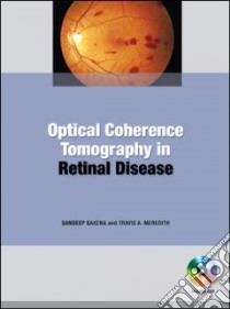 Optical Coherence Tomography in Retinal Disease libro in lingua di Saxena Sandeep (EDT), Meredith Travis A. M.D. (EDT), Chang Stanley (FRW)
