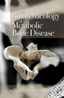 The Bioarchaeology of Metabolic Bone Disease libro in lingua di Brickley Megan, Ives Rachel