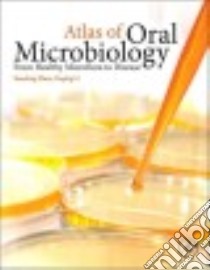 Atlas of Oral Microbiology libro in lingua di Zhou Xuedong (EDT), Li Yuqing (EDT)