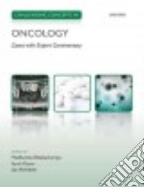 Challenging Concepts in Oncology libro in lingua di Bhattacharyya Madhumita Dr. Ph.D. (EDT), Payne Sarah Dr. Ph.D. (EDT), McNeish Iain Ph.D. (EDT)