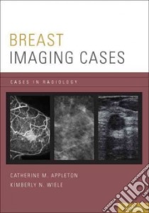 Breast Imaging Cases libro in lingua di Appleton Catherine M. M.D., Wiele Kimberly N. M.D., Holley Susan M.D. Ph.D. (CON)