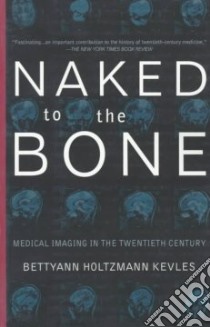 Naked to the Bone libro in lingua di Kevles Bettyann