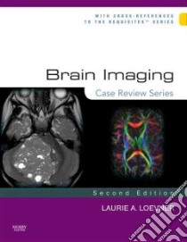 Brain Imaging libro in lingua di Loevner Laurie L. M.D.