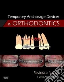 Temporary Anchorage Devices in Orthodontics libro in lingua di Nanda Ravindra, Uribe Flavio Andres