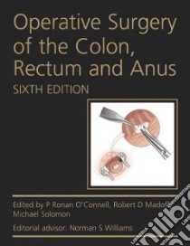 Operative Surgery of the Colon, Rectum and Anus libro in lingua di O'Connell P. Ronan M.D. (EDT), Madoff Robert D. M.D. (EDT), Solomon Michael J. (EDT)