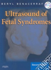 Ultrasound of Fetal Syndromes libro in lingua di Benacerraf Beryl R.