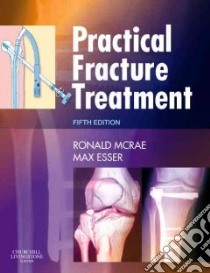 Practical Fracture Treatment libro in lingua di McRae Ronald, Esser Max