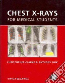 Chest X-Rays for Medical Students libro in lingua di Clarke Christopher, Dux Anthony