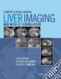 Liver Imaging libro in lingua di Altun Ersan M.D. (EDT), Elazzazi Mohamed M.D. Ph.D. (EDT), Semelka Richard C. M.D. (EDT)