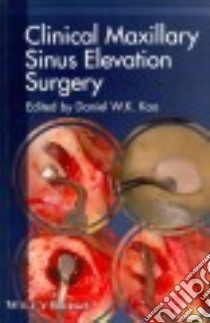 Clinical Maxillary Sinus Elevation Surgery libro in lingua di Kao Daniel W. K. (EDT)