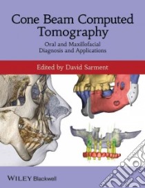 Cone Beam Computed Tomography libro in lingua di Sarment David (EDT)