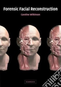 Forensic Facial Reconstruction libro in lingua di Wilkinson Caroline