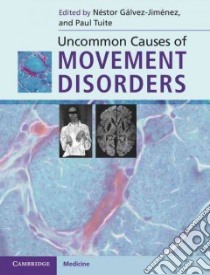 Uncommon Causes of Movement Disorders libro in lingua di Galvez-jimenez Nesot (EDT), Tuite Paul J. M.D. (EDT)