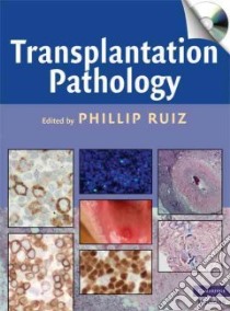 Transplantation Pathology libro in lingua di Ruiz Phillip (EDT)