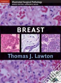 Breast libro in lingua di Lawton Thomas J.