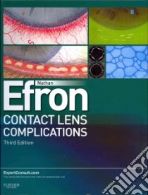 Contact Lens Complications libro in lingua di Efron Nathan