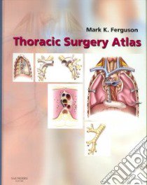 Thoracic Surgery Atlas libro in lingua di Ferguson Mark K.
