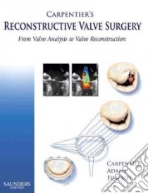 Carpentier's Reconstructive Valve Surgery libro in lingua di Carpentier Alain, Adams David H. M.D., Filsoufi Farzan, Williams Marcia (ILT)