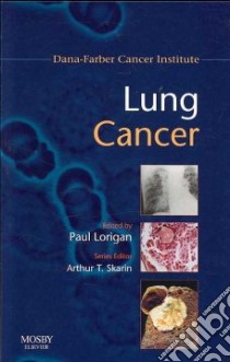 Lung Cancer libro in lingua di Arthur Skarin