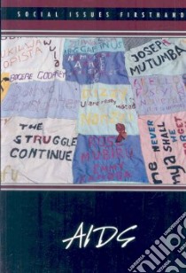 Aids libro in lingua di Kiesbye Stefan (EDT)