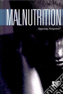 Malnutrition libro in lingua di Haerens Margaret (EDT)