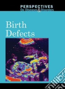 Birth Defects libro in lingua di Langwith Jacqueline (EDT)