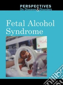 Fetal Alcohol Syndrome libro in lingua di Langwith Jacqueline (EDT)