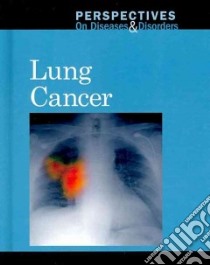 Lung Cancer libro in lingua di Langwith Jacqueline (EDT)