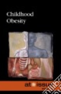 Childhood Obesity libro in lingua di Greenhaven Press (COR)