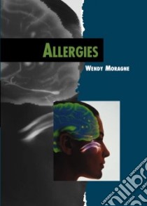 Allergies libro in lingua di Moragne Wendy