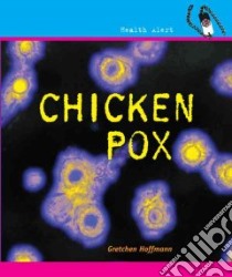 Chicken Pox libro in lingua di Hoffman Gretchen