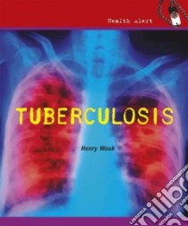 Tuberculosis libro in lingua di Wouk Henry