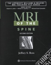 Mri of the Spine libro in lingua di Ross Jeffrey S. (EDT)