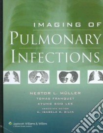Imaging of Pulmonary Infections libro in lingua di Lee Kyung Soo M.D. (EDT), Silva C. Isabela S. Ph.D. (EDT), Silva C. Isabela S. Ph.D.