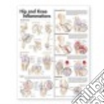 Hip and Knee Inflammations Anatomical Chart libro in lingua di Anatomical Chart Company (COR)