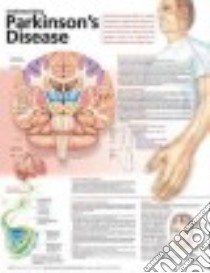 Understanding Parkinson's Disease Anatomical Chart libro in lingua di Anatomical Chart Company (COR)