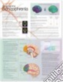 Understanding Schizophrenia Anatomical Chart libro in lingua di Anatomical Chart Company (EDT)