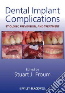 Dental Implant Complications libro in lingua di Froum Stuart J. (EDT)