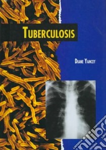 Tuberculosis libro in lingua di Yancey Diane