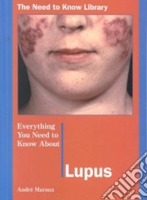 Everything You Need to Know About Lupus libro in lingua di Maraux Andre