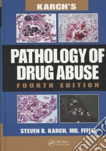 Karch's Pathology of Drug Abuse libro in lingua di Karch Steven B.