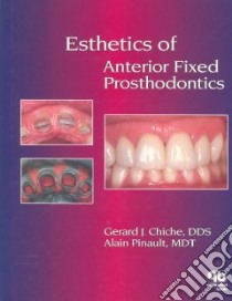 Esthetics of Anterior Fixed Prosthodontics libro in lingua di Chiche Gerard, Pinault Alain