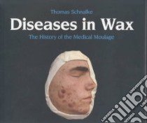 Diseases in Wax libro in lingua di Schnalke Thomas, Spatschek Kathy (TRN)