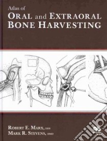 Atlas of Oral and Extraoral Bone Harvesting libro in lingua di Marx Robert E., Stevens Mark R.