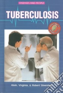 Tuberculosis libro in lingua di Silverstein Alvin, Silverstein Virginia B., Silverstein Robert