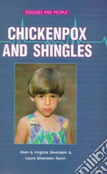 Chicken Pox and Shingles libro in lingua di Silverstein Alvin, Silverstein Virginia B., Nunn Laura Silverstein