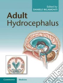 Adult Hydrocephalus libro in lingua di Rigamonti Daniele (EDT)