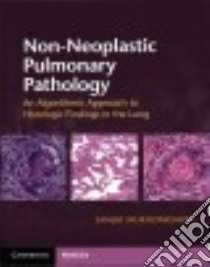Non-Neoplastic Pulmonary Pathology libro in lingua di Mukhopadhyay Sanjay