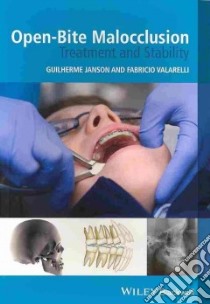 Open-Bite Malocclusion libro in lingua di Janson Guilherme (EDT), Valarelli Fabricio (EDT)